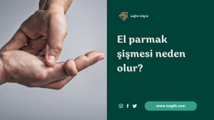 El parmak şişmesi neden olur?