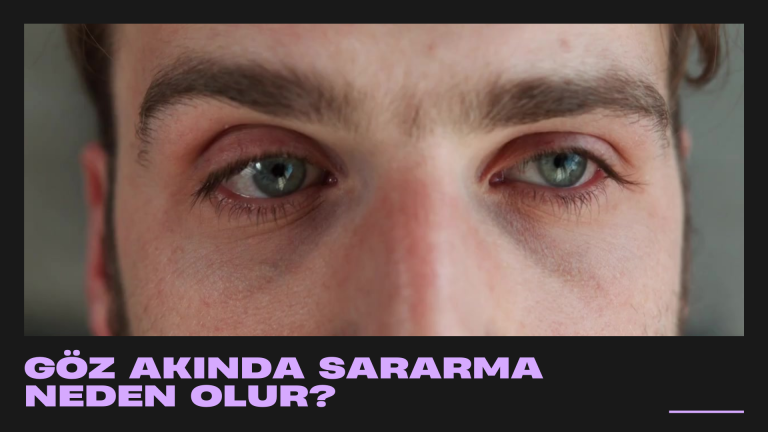 Göz akında sararma neden olur?