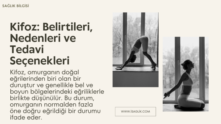 Kifoz: Belirtileri, Nedenleri ve Tedavi Seçenekleri