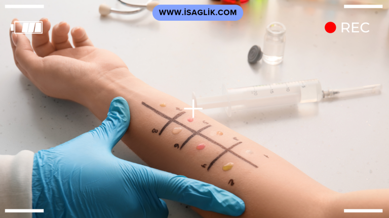 Alerji testi, kişinin belirli alerjenlere karşı hassasiyetini belirlemek için yapılan bir tıbbi testtir. Alerji testleri genellikle cilt üzerinde veya kan veya serum örneklerinde yapılabilir.