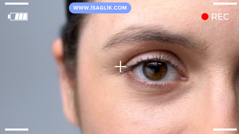 Astigmatizma, gözdeki korneanın (gözün ön yüzeyindeki saydam tabaka) veya göz merceğinin düzensiz bir şekilde kavisli olması durumudur. Bu düzensizlik, ışığın göze düzgün bir şekilde odaklanmasını engeller, görüntüyü bulanık veya bozuk hale getirir.