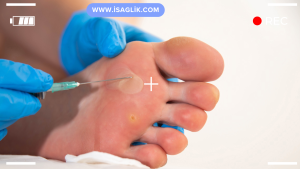 Ayağınıza iğne battığında yapmanız gerekenler şunlar olabilir: Sakin Olun: Panik yapmayın ve sakin kalın. İğne batması çoğu durumda acı vericidir ancak genellikle ciddi değildir.