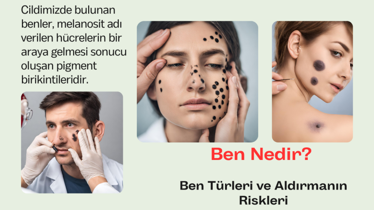 Ben Nedir? Netür benler vardır? Ben aldırmak kanser yapar mı? Ben aldırma sonrası cilt kanseri oluşur mu? Ben Aldırmak zararlı mı?