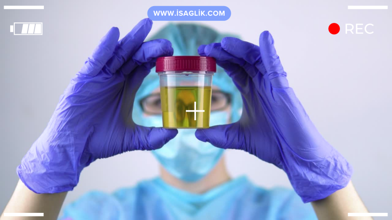 Çocuklarda gaita testi pozitif çıkması, dışkı örneğindeki belirli maddelerin veya mikroorganizmaların varlığının tespit edildiğini ifade eder.