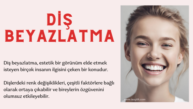 DİŞ BEYAZLATMA