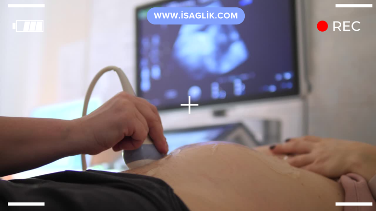 Detaylı ultrason, ultrasonografik görüntülemenin daha detaylı bir versiyonudur ve genellikle fetusun gelişimi ve sağlığı hakkında daha ayrıntılı bilgi sağlamak için kullanılır.