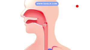 Göğüs bölgesindeki yemek borusu kanserleri, özellikle tanı konulduğunda ileri aşamalara ulaşmış olabilir ve tedavi süreci karmaşık olabilir. Tedavi planı, kanserin evresine, büyümesine ve yayılmasına bağlı olarak değişebilir.