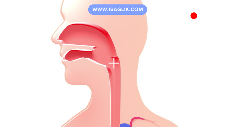 Göğüs bölgesindeki yemek borusu kanserleri, özellikle tanı konulduğunda ileri aşamalara ulaşmış olabilir ve tedavi süreci karmaşık olabilir. Tedavi planı, kanserin evresine, büyümesine ve yayılmasına bağlı olarak değişebilir.