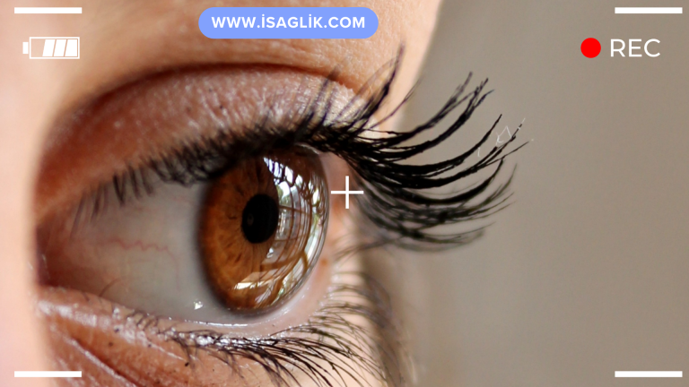 Göz seğirmesi, göz kapaklarının istemsiz ve tekrarlayıcı bir şekilde kasılması durumudur. Bilimsel olarak "miyokimya" olarak adlandırılan bu durum, genellikle stres, yorgunluk, kafein tüketimi, göz kuruluğu, vitamin veya mineral eksikliği gibi faktörlerden kaynaklanır.