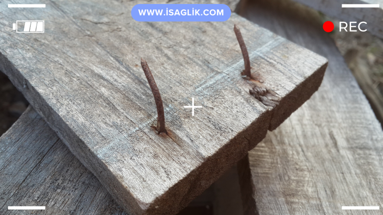 "Eğer paslı bir çivi deriye saplanırsa, tetanoz riski artar" gibi bir inanış yaygındır, ancak bu doğru değildir. Tetanoz, Clostridium tetani adlı bir bakterinin neden olduğu bir enfeksiyondur ve bu bakteri toprak, toz, dışkı ve paslı metal gibi birçok ortamda bulunabilir.