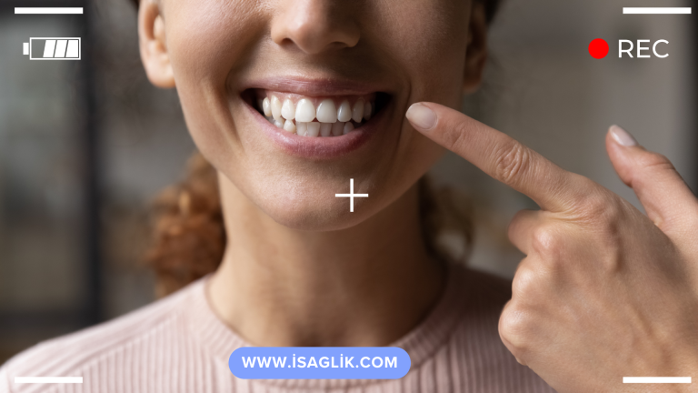 Hollywood Smile, diş estetiği alanında popüler olan bir terimdir ve genellikle Hollywood yıldızlarının sahip olduğu beyaz, düzgün ve çekici dişlere referans yapar. Hollywood Smile, bir dizi diş estetiği prosedürünü içerebilir ve kişinin mevcut diş yapısına, isteklerine ve bütçesine bağlı olarak değişebilir.