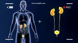 İdrar yolu ve böbrek taşları, üriner sistemdeki önemli sorunlardan biridir. Bu durum, kişinin yaşam kalitesini önemli ölçüde etkileyebilir.