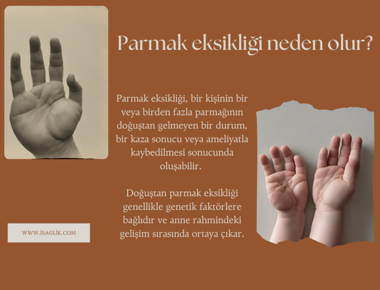 Parmak eksikliği neden olur?