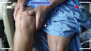 Plastik cerrahi, estetik veya rekonstrüktif nedenlerle yapılan cerrahi işlemleri içeren bir tıp dalıdır. Dikiş izleri, plastik cerrahideki cerrahi kesilerin kapatılması için kullanılan dikişlerden kaynaklanan izlerdir.