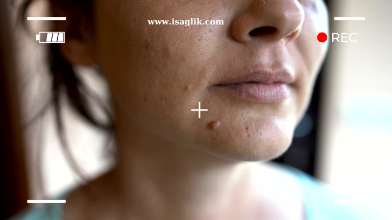 Yarısı kırılan dişin tedavisi, kırılan bölgenin büyüklüğüne, dişin konumuna ve genel diş sağlığı durumuna bağlı olarak değişebilir.