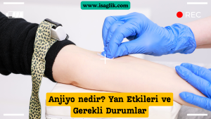 Anjiyo, tıbbi bir prosedür olup, damarların içine ince bir kateter yerleştirilerek yapılır. Bu prosedür sırasında, genellikle kasıklardaki veya bileklerdeki arterlerden girilir ve kateter, kalbe veya diğer vücut bölgelerine ulaşmak için kullanılır.
