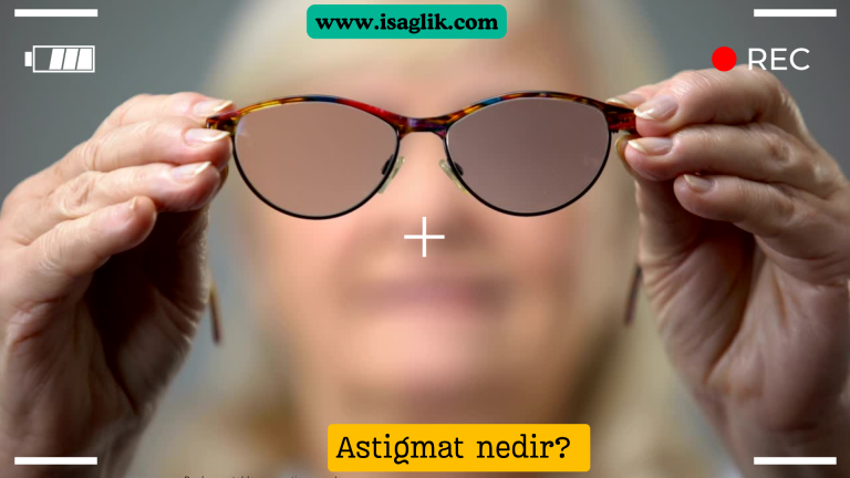 Astigmat, gözün kornea veya merceğinin düzensiz bir şekle sahip olması nedeniyle ışığın düzgün bir şekilde odaklanamaması sonucu görülen bir göz kusurudur. Normalde, kornea ve mercek düzgün bir küresel şekle sahiptir ve ışık doğru bir şekilde retinanın üzerine odaklanır.