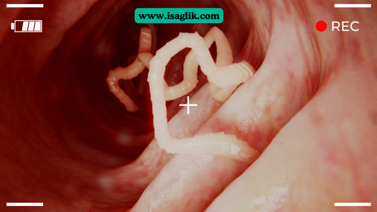 Bağırsak parazitleri, özellikle kıl kurdu (Enterobius vermicularis) ve tenya (Taenia saginata ve Taenia solium gibi) gibi, insan bağırsaklarında yaşayan parazitlerdir. Bu parazitlerin dökülmesi ve tedavisi genellikle ilaçlarla yapılır.