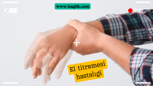 El titremesi, tıbbi olarak tremor olarak bilinen, ellerin istemsiz ve ritmik olarak sarsılmasıyla karakterize bir durumdur. Bu durum, yaşam kalitesini olumsuz etkileyebilir ve günlük aktivitelerin yapılmasını zorlaştırabilir.