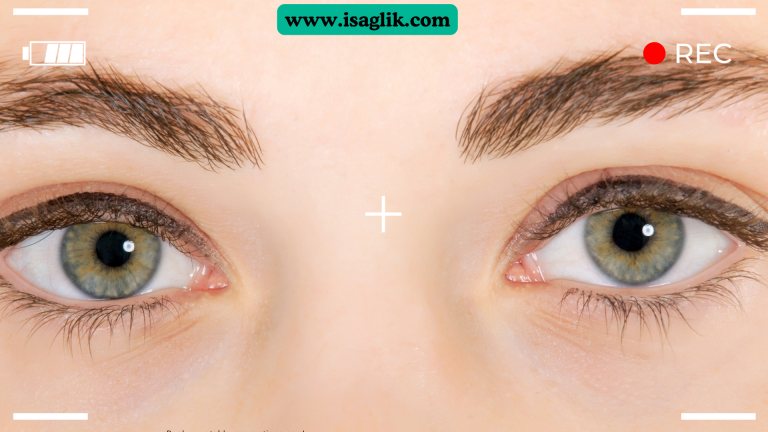 Göz taşı, gözdeki gözyaşı kanallarının tıkanması nedeniyle oluşan bir durumdur. Gözyaşı, gözlerin nemli kalmasına yardımcı olan ve gözleri koruyan bir sıvıdır. Göz taşı, gözyaşı akışının normal şekilde gerçekleşmediği durumlarda ortaya çıkar. Gözyaşı, gözlerdeki kirleri temizler ve gözleri nemli tutar. Ancak gözyaşı kanallarının tıkanması durumunda gözyaşı normal bir şekilde dışarıya akamaz ve göz taşı oluşur.