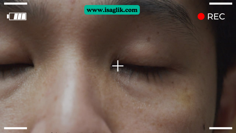 Gözdeki ağrı, yanma, batma, kaşıntı ve kızarıklık gibi belirtiler genellikle çeşitli göz hastalıklarının veya dış etkenlerin bir sonucu olarak ortaya çıkar. Bu belirtilerin altında yatan potansiyel nedenler arasında enfeksiyonlar, alerjiler, yabancı cisimlerin varlığı, göz yorgunluğu, kuru göz sendromu, kontakt lens kullanımı, travma veya ciddi durumlarda daha ciddi göz hastalıkları bulunabilir.