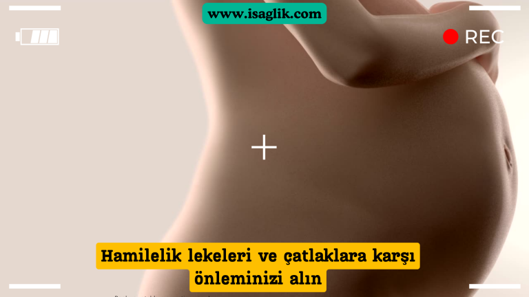 Hamilelik döneminde ciltte oluşabilen lekeler ve çatlaklar, pek çok kadının endişe ettiği bir durumdur. Ancak, doğru önlemler alınarak bu durumların oluşumu önemli ölçüde azaltılabilir.