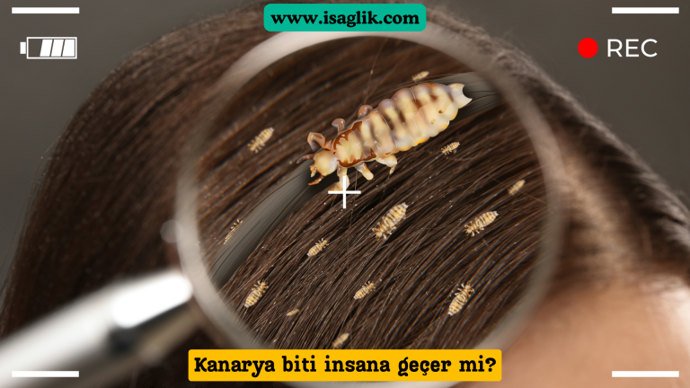 Kanarya bitleri (Dermanyssus gallinae), genellikle kuşlarda ve bazı evcil hayvanlarda bulunan bir tür parazittir. Bu parazitlerin insanlara geçip geçmediği konusunda net bir kanıt bulunmamaktadır. Bununla birlikte, kuşlarla temas eden kişilerde bazı alerjik reaksiyonlara neden olabileceği bilinmektedir.
