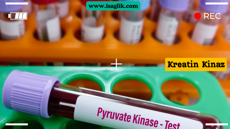 Kreatin kinaz yüksekliği, vücutta oluşan bir enzim olan kreatin kinazın normalden yüksek seviyelerde bulunması durumunu ifade eder. Bu durum, çeşitli nedenlerden kaynaklanabilir ve genellikle kas hasarı, kalp krizi, kas hastalıkları veya tiroid bezinin aşırı aktif olması gibi durumlarla ilişkilendirilir.