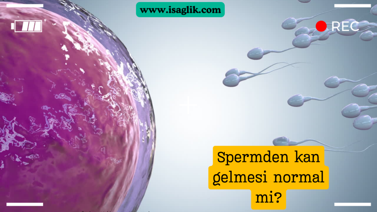 "Spermden kan gelmesi" olarak adlandırılan durum, tıbbi terimle "hematospermi" olarak bilinir. Hematospermi, nadir görülen ancak genellikle ciddiye alınması gereken bir durumdur.
