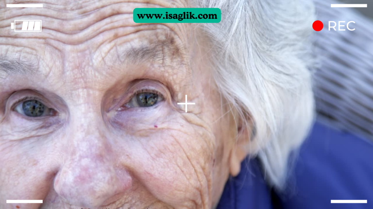 Sarı nokta hastalığı, yaşa bağlı makula dejenerasyonu (AMD) olarak da bilinir. Bu durum, retina tabakasının merkezi bölgesinde, yani makula adı verilen küçük bir alanında ortaya çıkan bir hastalıktır. Sarı nokta hastalığı, ilerleyici bir durumdur ve zamanla görme yeteneğini etkileyebilir.