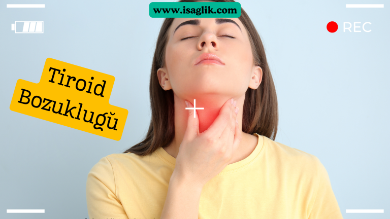 Tiroid bezi, vücudun metabolizmasını düzenleyen önemli bir organdır. Bu bezde meydana gelen bozukluklar, vücuttaki birçok sistemde belirtilere neden olabilir. En yaygın tiroid bozukluklarından bazıları hipotiroidizm ve hipertiroidizmdir.