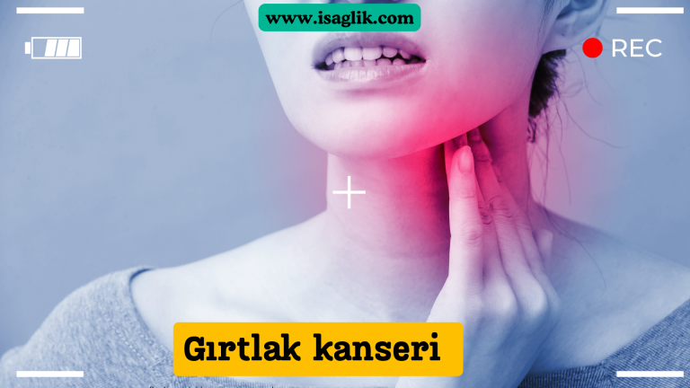 Gırtlak kanseri, gırtlakta (larenks) başlayan ve ses tellerini etkileyen bir tür kanserdir. Bu tür kanser genellikle sigara içimi, alkol tüketimi, aşırı ses kullanımı ve bazı viral enfeksiyonlar gibi faktörlerle ilişkilendirilir.