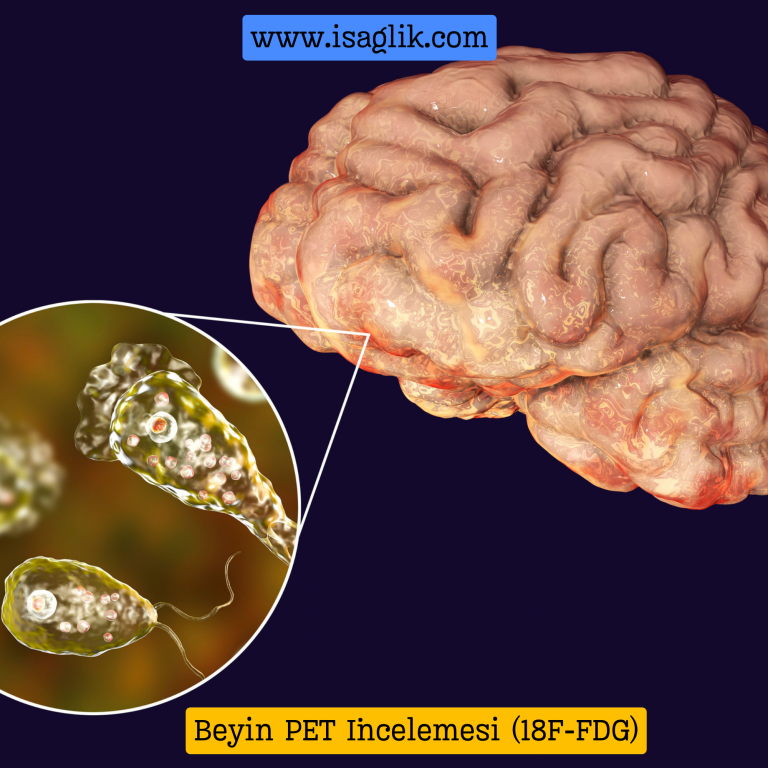 Beyin Pozitron Emisyon Tomografisi (PET) incelemesi, beyin aktivitesini ölçmek ve görüntülemek için kullanılan bir tıbbi görüntüleme tekniğidir.