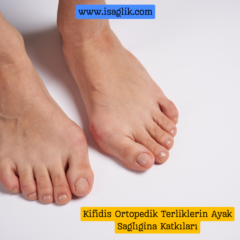 Halluks Valgus, ayak başparmağının biriken baskıya maruz kalması sonucu şekil değiştirmesi ve diğer parmakların üzerine doğru kaymasıyla karakterize edilen bir ayak deformitesidir.