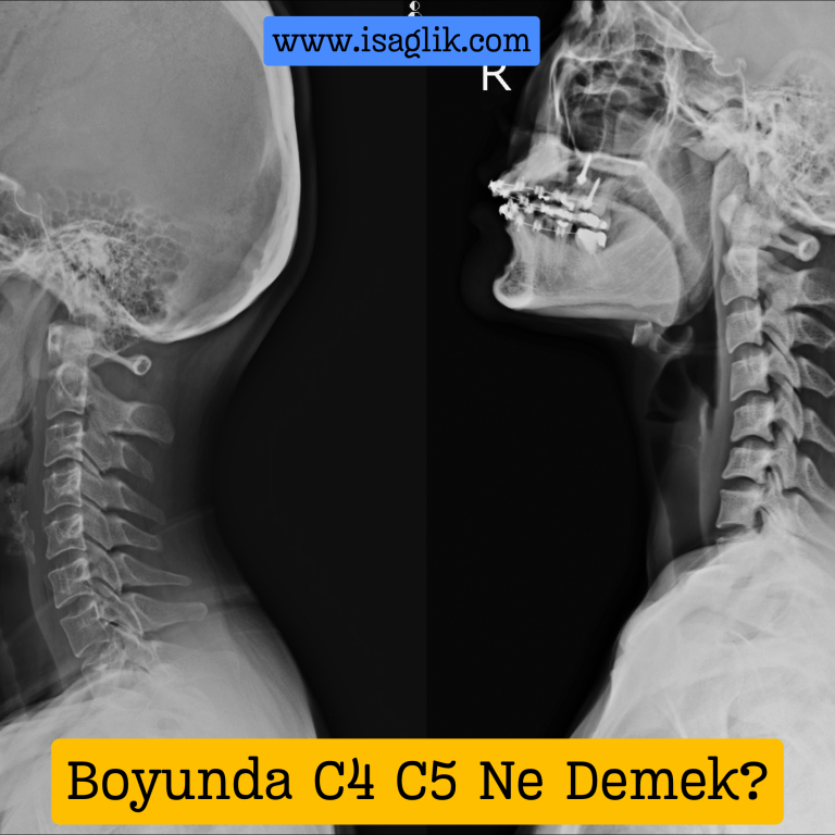 Boyun omurgası, insan vücudunda önemli bir yapıdır ve toplamda yedi omurdan oluşur. Bu omurlar, kafatasından başlayarak omuriliği korur ve boynun hareket kabiliyetini sağlar.