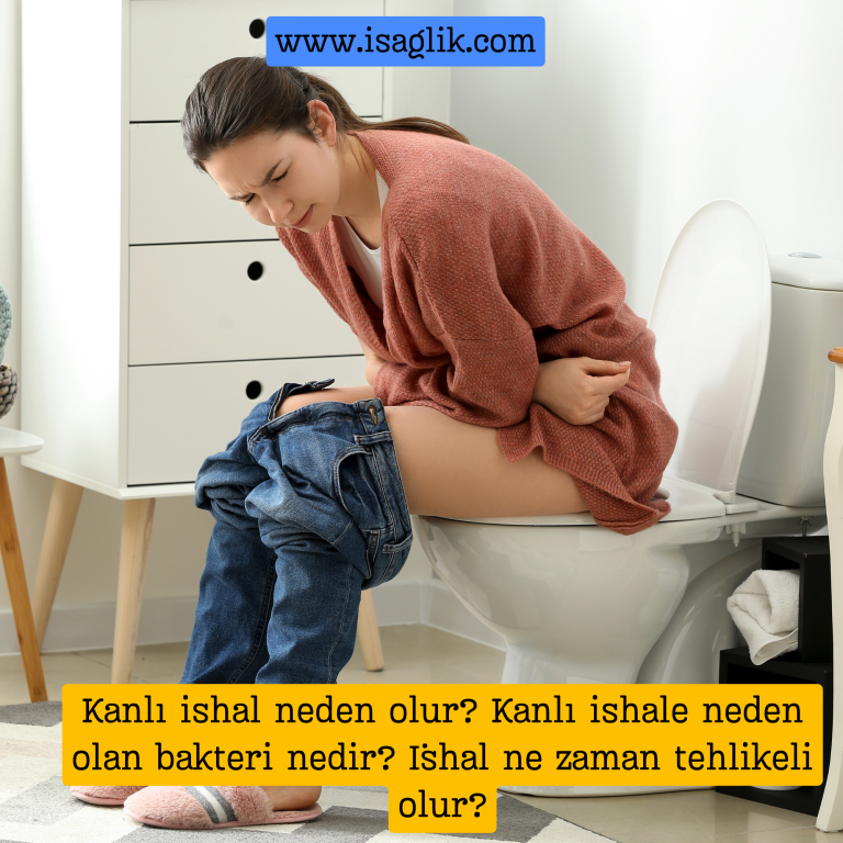 Kanlı ishal, dışkıda kan bulunmasıyla karakterize edilen ciddi bir sağlık sorunudur. Bu durum, genellikle bağırsaklarda bir enfeksiyon veya iltihaplanma belirtisidir.